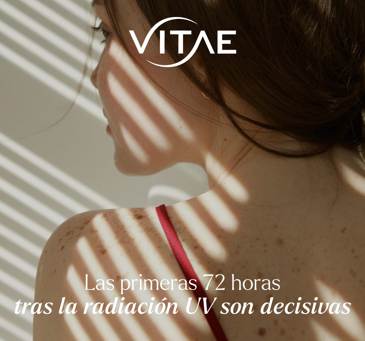 ¿Qué ocurre en la piel después de una quemadura solar?