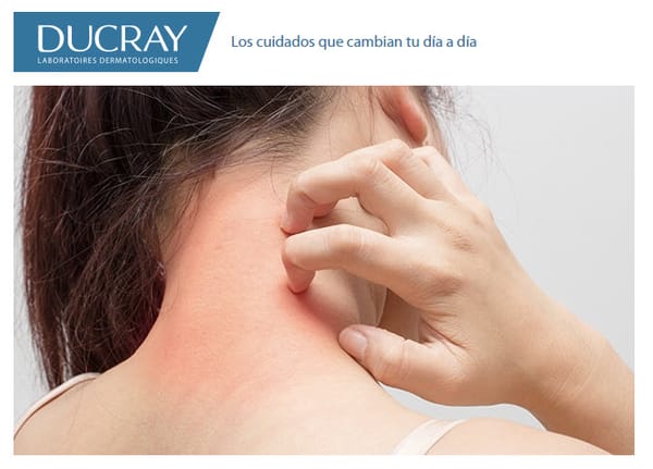 ¿Tu piel tiende a la atopia?👨‍⚕️¡DEXYANE es tu Solución!😍